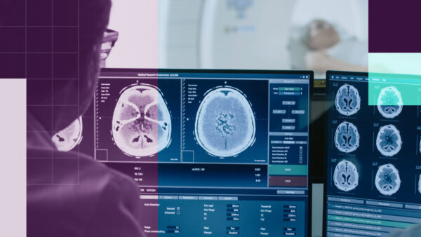 A professional at a desk with screens that show brain scans.